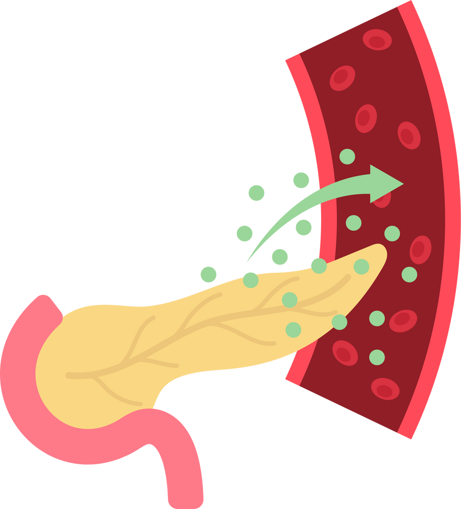 blood sugar level Type 1 infection cancer high low medical beta cell anatomy liver disease endocrine glycogen enzymes system